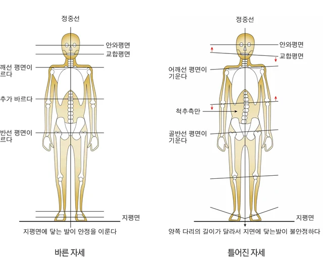 골반과 어깨의 기울기를 함께 표시한 전신 자세 분석 도해