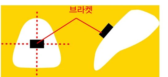치아 표면에 십자선을 긋고 그 중앙에 브라켓을 일률적으로 부착하는 방식을 나타낸 일러스트